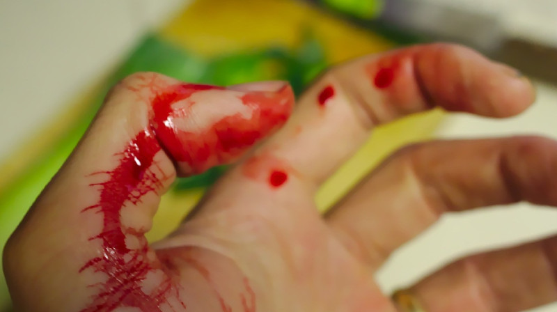 Емханаға келген науқас дәрігерді пышақтады