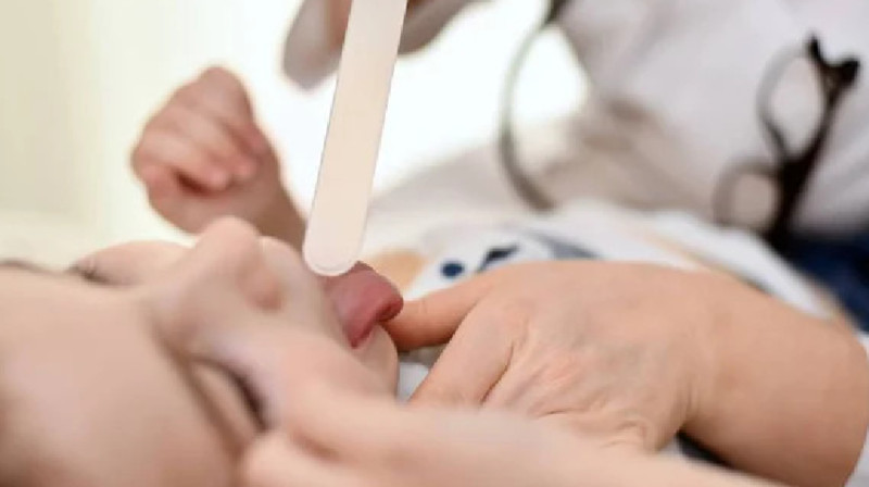 Балабақшада 6 бала скарлатинаға шалдығып, біреуі қайтыс болды