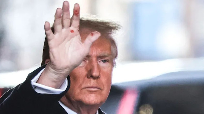 Трамптың алақанындағы дақтар түрлі қауесет тудырды