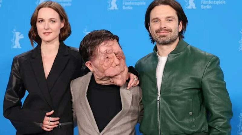 Берлиналеде нейрофиброматозбен ауыратын актер өнер көрсетті