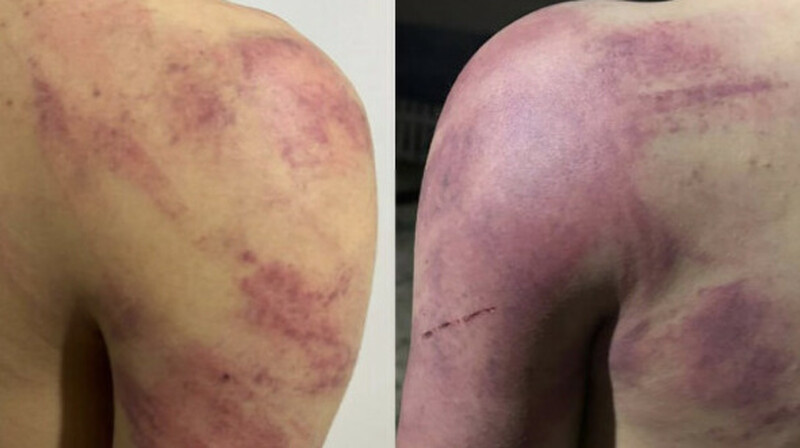 «Үй шаруасына көмектеспеген»: Бір топ бала 8-сынып оқушысын аяусыз ұрып тастады