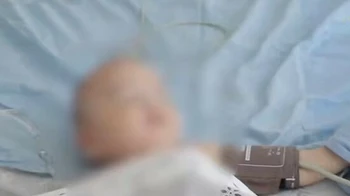 10 айлық балаға анасы фри беріп, ішегінен айырды