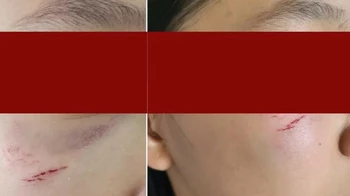 "Мойнынан сүйіп, кеудесінен ұстаған": Ер адам 12 және 2 жастағы қыздарға шабуылдады