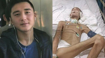 Әскерде жараланған Ербаян Мұхтар Түркиядан елге оралды