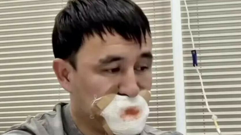 Қырғызстанда қызбен сүйіскен жігіт тілінен айрылды