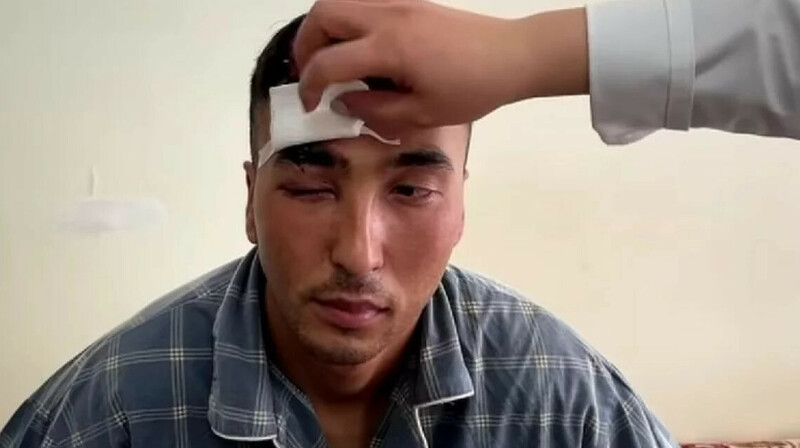 Жамбыл облысында әскери басына бөтелке жарам деп көзінен айырылды