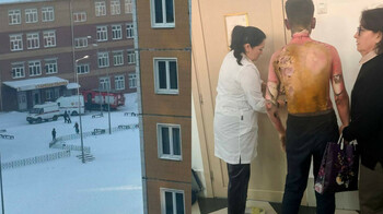 8-сынып оқушысы өзін мазақтаған сыныптастарының үстіне бензин құйып, өртеп жіберген