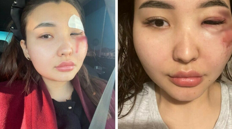 Атырауда блогерді соққыға жыққандар сотталды