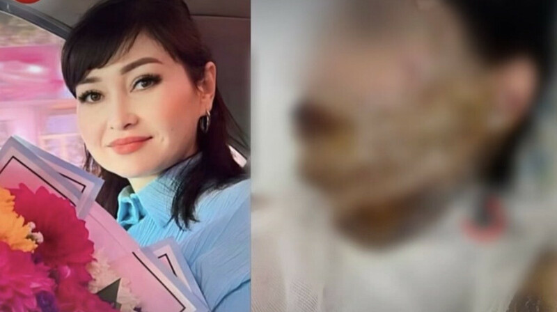 «Мен сені адам танымастай қылып тастаймын»: Шымкентте ер адам әйеліне қышқыл төкті